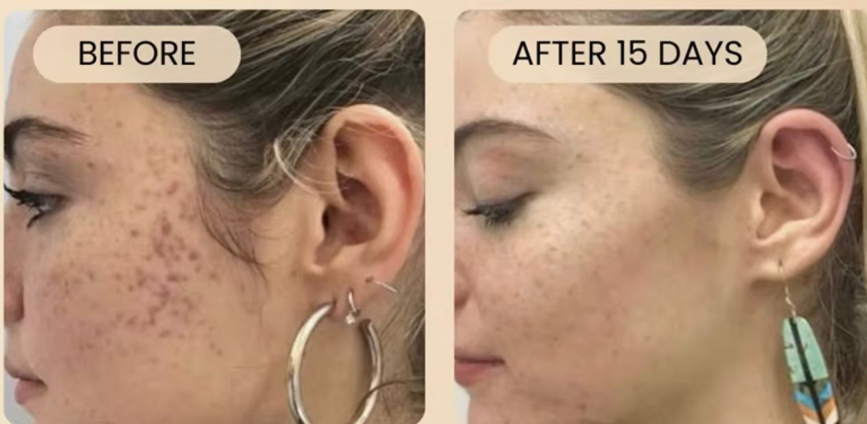 Turmeric Facial Cream