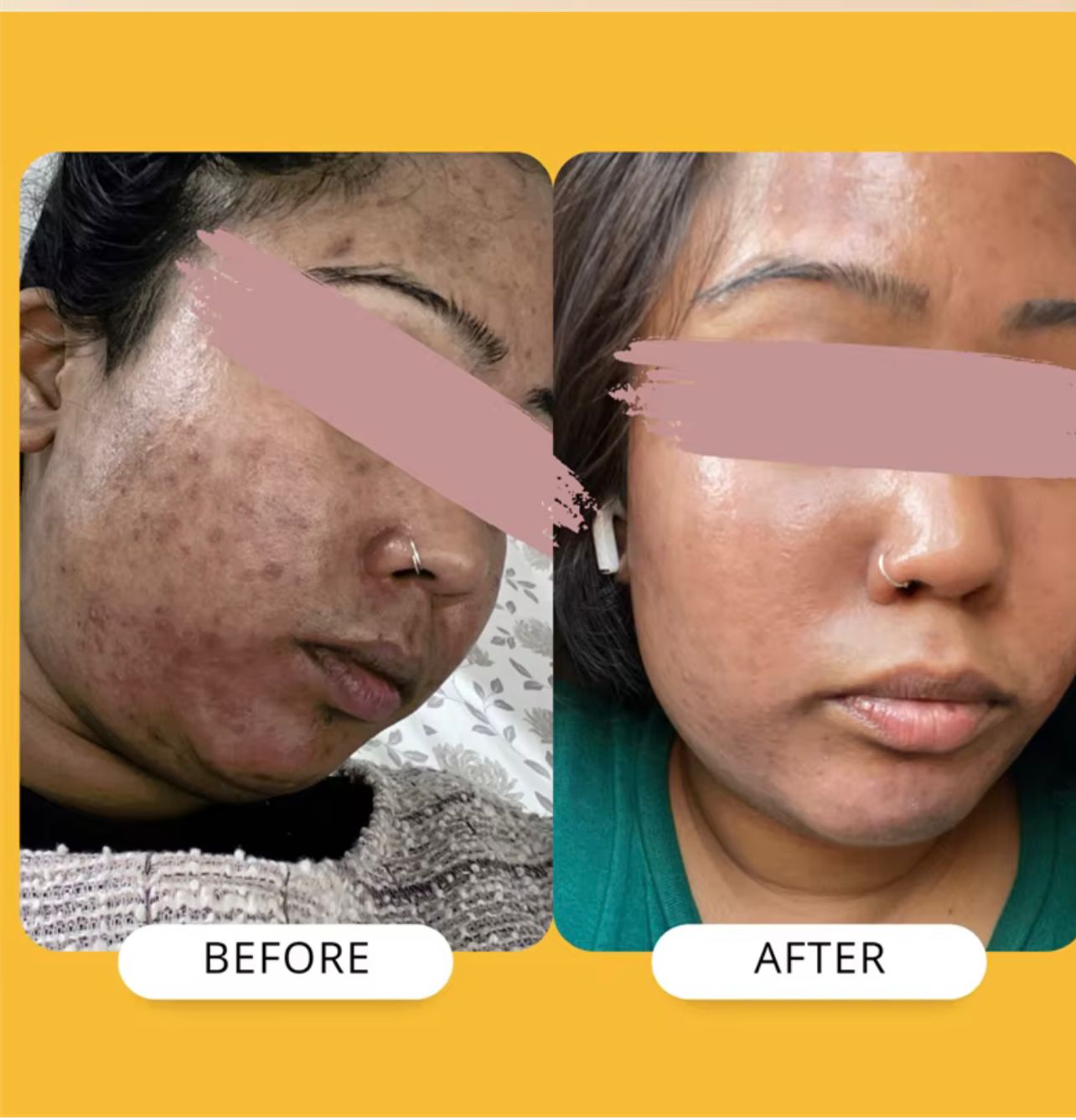 Turmeric Facial Cream